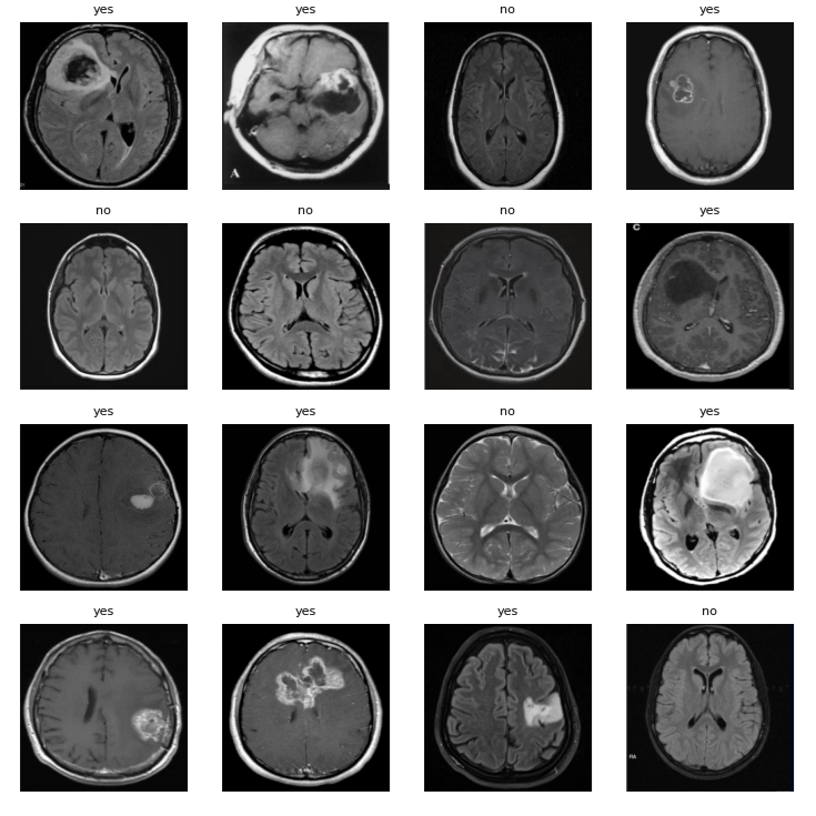 Images of brain